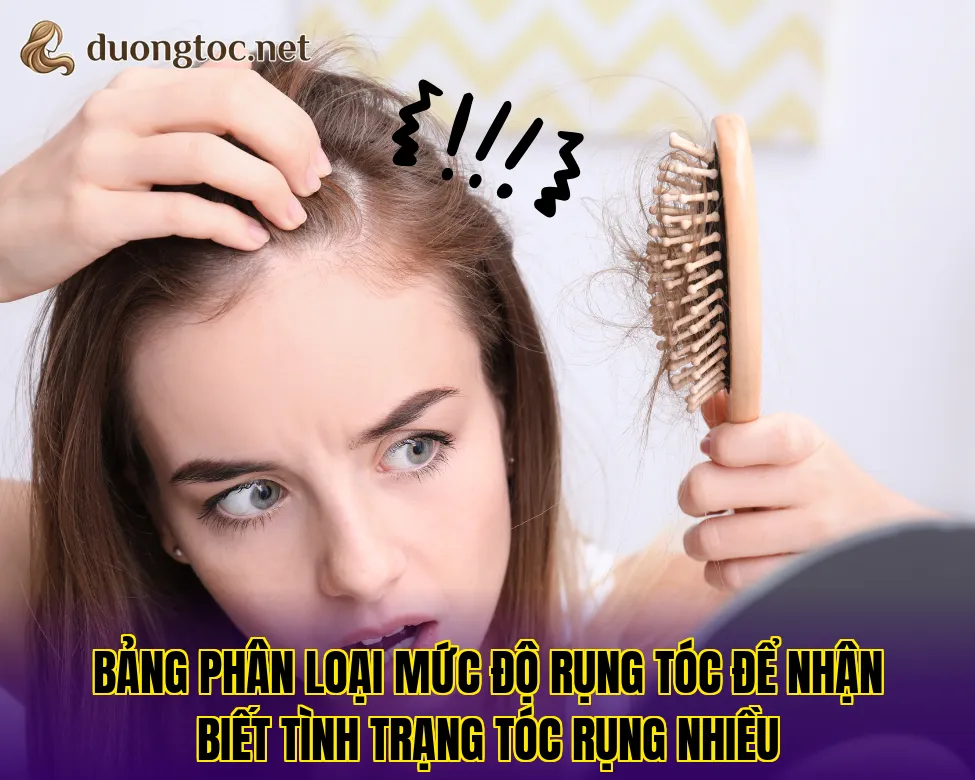 Bảng phân loại mức độ rụng tóc để nhận biết tình trạng tóc rụng nhiều