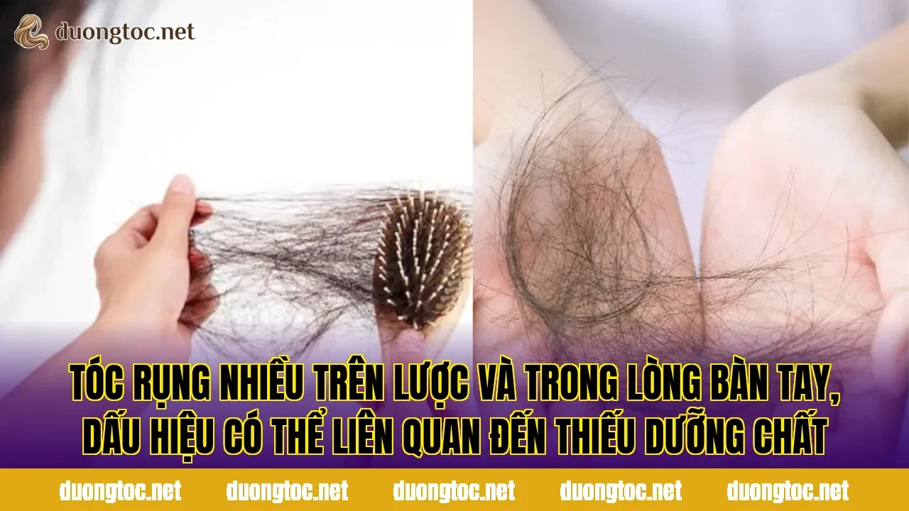 Tóc rụng nhiều trên lược và trong lòng bàn tay, dấu hiệu có thể liên quan đến thiếu dưỡng chất